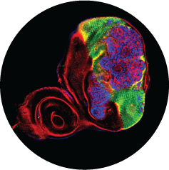 Epigenetic inheritance in development and cancer